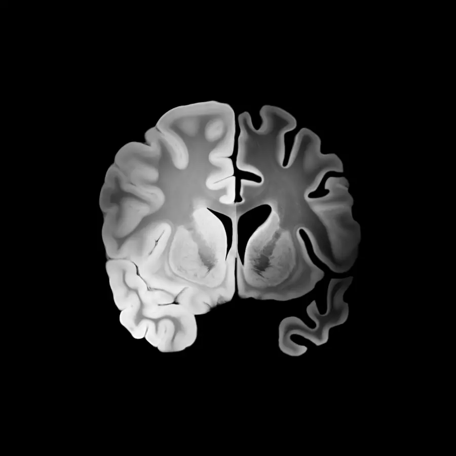 Cognitive Science of Learning